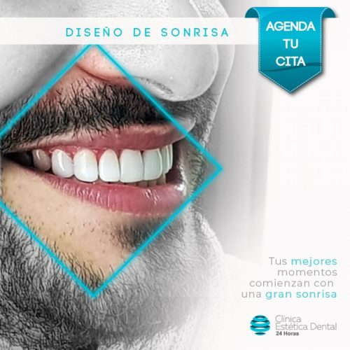 diseño-de-sonrisa-bogota-900x900